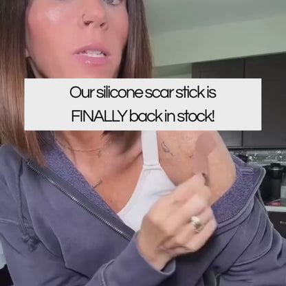 Scar Solutions Silicone Scar Stick